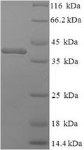 Recombinant Mouse Complement C1q subcomponent subunit A (C1qa) – Figure 1 of 1