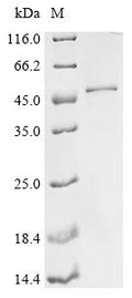 (Tris-Glycine gel) Discontinuous SDS-PAGE (reduced) with 5% enrichment gel and 15% separation gel.