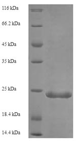 Recombinant Human Complement C5 (C5), partial – Figure 1 of 1