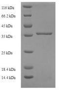 Recombinant Human Complement component C8 gamma chain (C8G) – Figure 1 of 1
