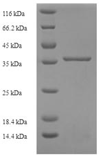 Recombinant Human Complement component C8 gamma chain (C8G) – Figure 1 of 1