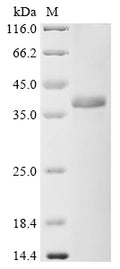 (Tris-Glycine gel) Discontinuous SDS-PAGE (reduced) with 5% enrichment gel and 15% separation gel.
