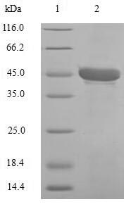 Recombinant Human Carbonic anhydrase 1 (CA1) – Figure 1 of 1