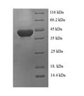 (Tris-Glycine gel) Discontinuous SDS-PAGE (reduced) with 5% enrichment gel and 15% separation gel.