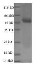 Recombinant Human Carbonic anhydrase 12 (CA12), partial – Figure 1 of 1