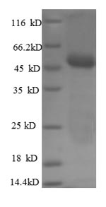 Recombinant Human Carbonic anhydrase 12 (CA12), partial – Figure 1 of 1