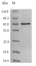 Recombinant Human Carbonic anhydrase 2 (CA2) – Figure 1 of 1