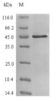 Recombinant Human Carbonic anhydrase 2 (CA2) – Figure 1 of 1