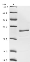 (Tris-Glycine gel) Discontinuous SDS-PAGE (reduced) with 5% enrichment gel and 15% separation gel.