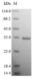(Tris-Glycine gel) Discontinuous SDS-PAGE (reduced) with 5% enrichment gel and 15% separation gel.