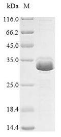 (Tris-Glycine gel) Discontinuous SDS-PAGE (reduced) with 5% enrichment gel and 15% separation gel.