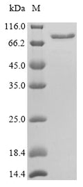 Recombinant Mouse Calreticulin (Calr) – Figure 1 of 1