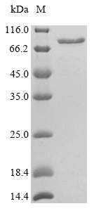 Recombinant Mouse Calreticulin (Calr) – Figure 1 of 1