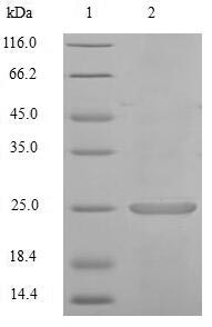 Recombinant Mouse Calcium/calmodulin-dependent protein kinase II inhibitor 1 (Camk2n1) – Figure 1 of 1