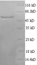 Recombinant Rat Calcium/calmodulin-dependent protein kinase type IV (Camk4) – Figure 1 of 1
