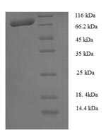 Recombinant Human Calpain-1 catalytic subunit (CAPN1) – Figure 1 of 1