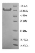 Recombinant Mouse Calpain-1 catalytic subunit (Capn1) – Figure 1 of 1