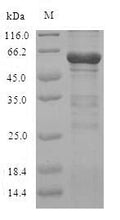 Recombinant Pig Calpain-2 catalytic subunit (CAPN2) – Figure 1 of 1