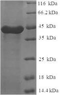 Recombinant Human Calpain small subunit 1 (CAPNS1) – Figure 1 of 1