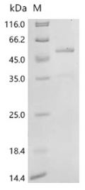 Recombinant Human Caspase-2 (CASP2) – Figure 1 of 1