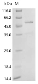 Recombinant Human Caspase-2 (CASP2) – Figure 1 of 1