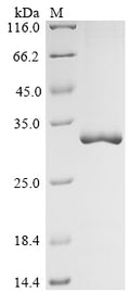 (Tris-Glycine gel) Discontinuous SDS-PAGE (reduced) with 5% enrichment gel and 15% separation gel.