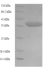 Recombinant Human Caspase-5 (CASP5), partial – Figure 1 of 1
