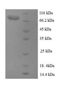 Recombinant Human Extracellular calcium-sensing receptor (CASR), partial – Figure 1 of 1