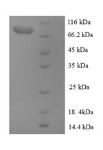 Recombinant Human Extracellular calcium-sensing receptor (CASR), partial – Figure 1 of 1
