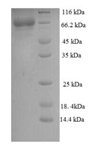 Recombinant Human Calpastatin (CAST) – Figure 1 of 1