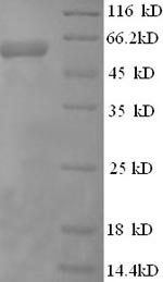 Recombinant Human Cystathionine beta-synthase (CBS), partial – Figure 1 of 1