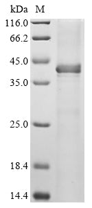 (Tris-Glycine gel) Discontinuous SDS-PAGE (reduced) with 5% enrichment gel and 15% separation gel.