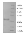 Recombinant Human C-C motif chemokine 16 (CCL16) – Figure 1 of 1