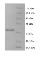 Recombinant Human C-C motif chemokine 16 (CCL16) – Figure 1 of 1