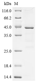(Tris-Glycine gel) Discontinuous SDS-PAGE (reduced) with 5% enrichment gel and 15% separation gel.