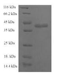 Recombinant Human C-C motif chemokine 25 (CCL25) – Figure 1 of 1