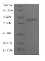 Recombinant Human C-C motif chemokine 25 (CCL25) – Figure 1 of 1