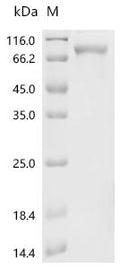 (Tris-Glycine gel) Discontinuous SDS-PAGE (reduced) with 5% enrichment gel and 15% separation gel.