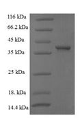 Recombinant Human G1/S-specific cyclin-D1 (CCND1) – Figure 1 of 1