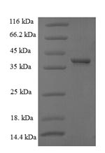 Recombinant Human G1/S-specific cyclin-D1 (CCND1) – Figure 1 of 1
