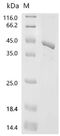 (Tris-Glycine gel) Discontinuous SDS-PAGE (reduced) with 5% enrichment gel and 15% separation gel.