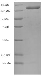 Recombinant Human T-complex protein 1 subunit beta (CCT2) – Figure 1 of 1