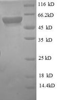Recombinant Human Monocyte differentiation antigen CD14 (CD14) – Figure 1 of 1