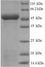 Recombinant Human Antigen-presenting glycoprotein CD1d (CD1D), partial – Figure 1 of 1