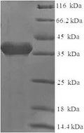 Recombinant Human T-cell surface antigen CD2 (CD2), partial – Figure 1 of 1