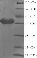 Recombinant Human T-cell surface antigen CD2 (CD2), partial – Figure 1 of 1