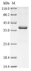 (Tris-Glycine gel) Discontinuous SDS-PAGE (reduced) with 5% enrichment gel and 15% separation gel.