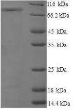 Recombinant Human CD44 antigen (CD44), partial – Figure 1 of 1