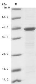 (Tris-Glycine gel) Discontinuous SDS-PAGE (reduced) with 5% enrichment gel and 15% separation gel.