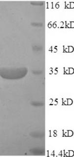 Recombinant Mouse Membrane cofactor protein (Cd46), partial – Figure 1 of 1